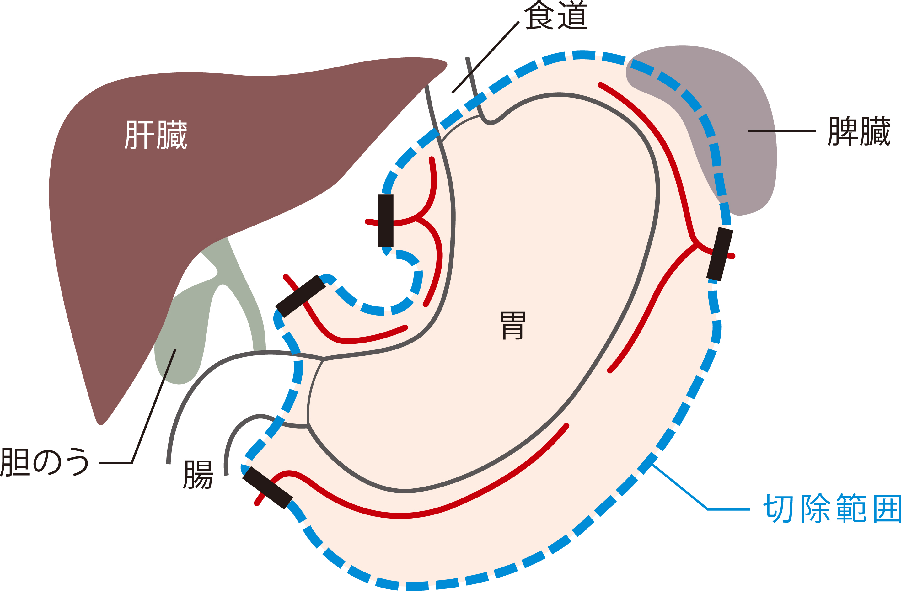 ロボット手術センター手術画像