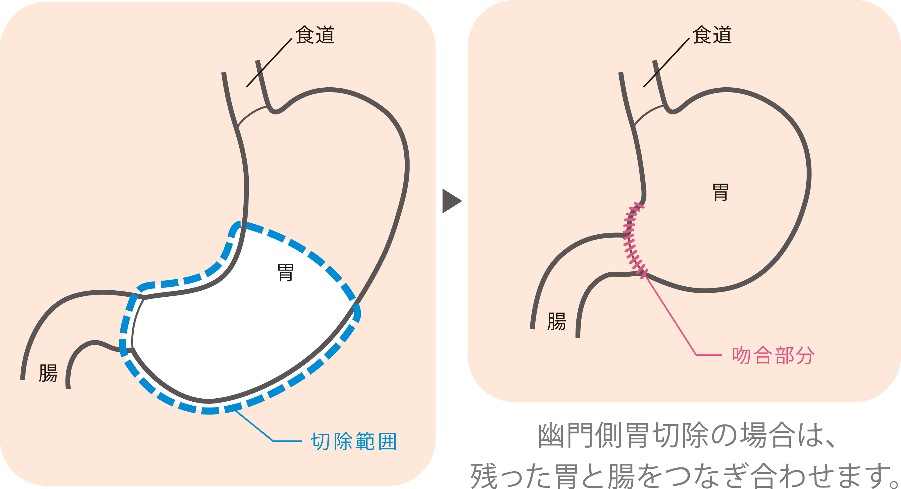 ロボット手術センター手術画像