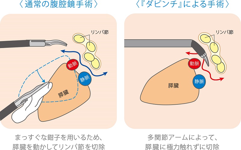 ロボット手術センター手術画像