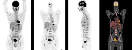 ペット検査 ストア 腎臓が白